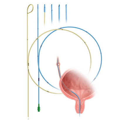 Ureteral-Catheters